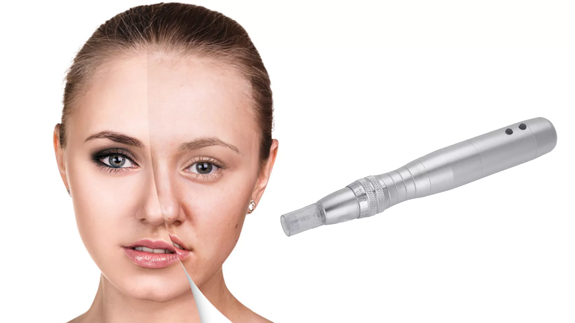 Bild einer jungen Frau mit Micro Needling Behandlung im Gesicht.
